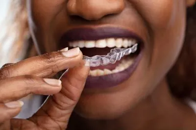woman putting in her new Invisalign clear aligners from Gina Biedermann DDS in Keller, TX