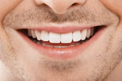man smiling after periodontal treatment from Gina Biedermann DDS cleared his smile up