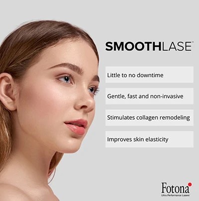 Woman with smooth skin &mdash; SmoothLase treatment benefits listed
